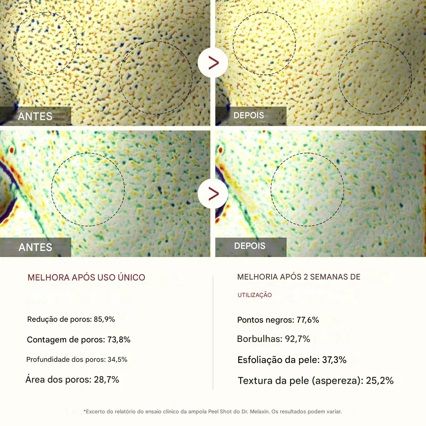 InfiniteShot - Ampola esfoliante de arroz