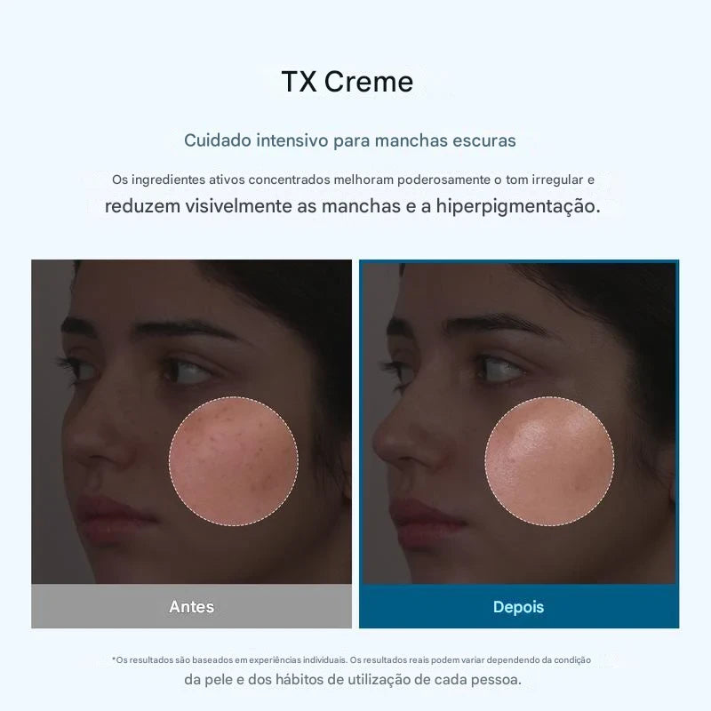 Creme Facial Despigmentante – Reduz as manchas e uniformiza