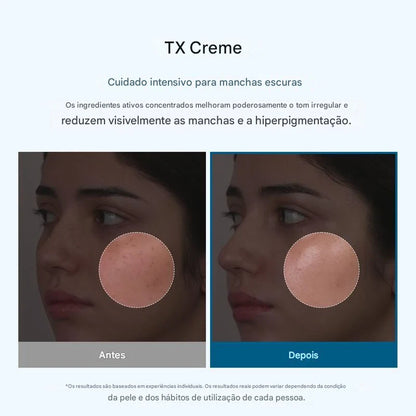 Creme Facial Despigmentante – Reduz as manchas e uniformiza
