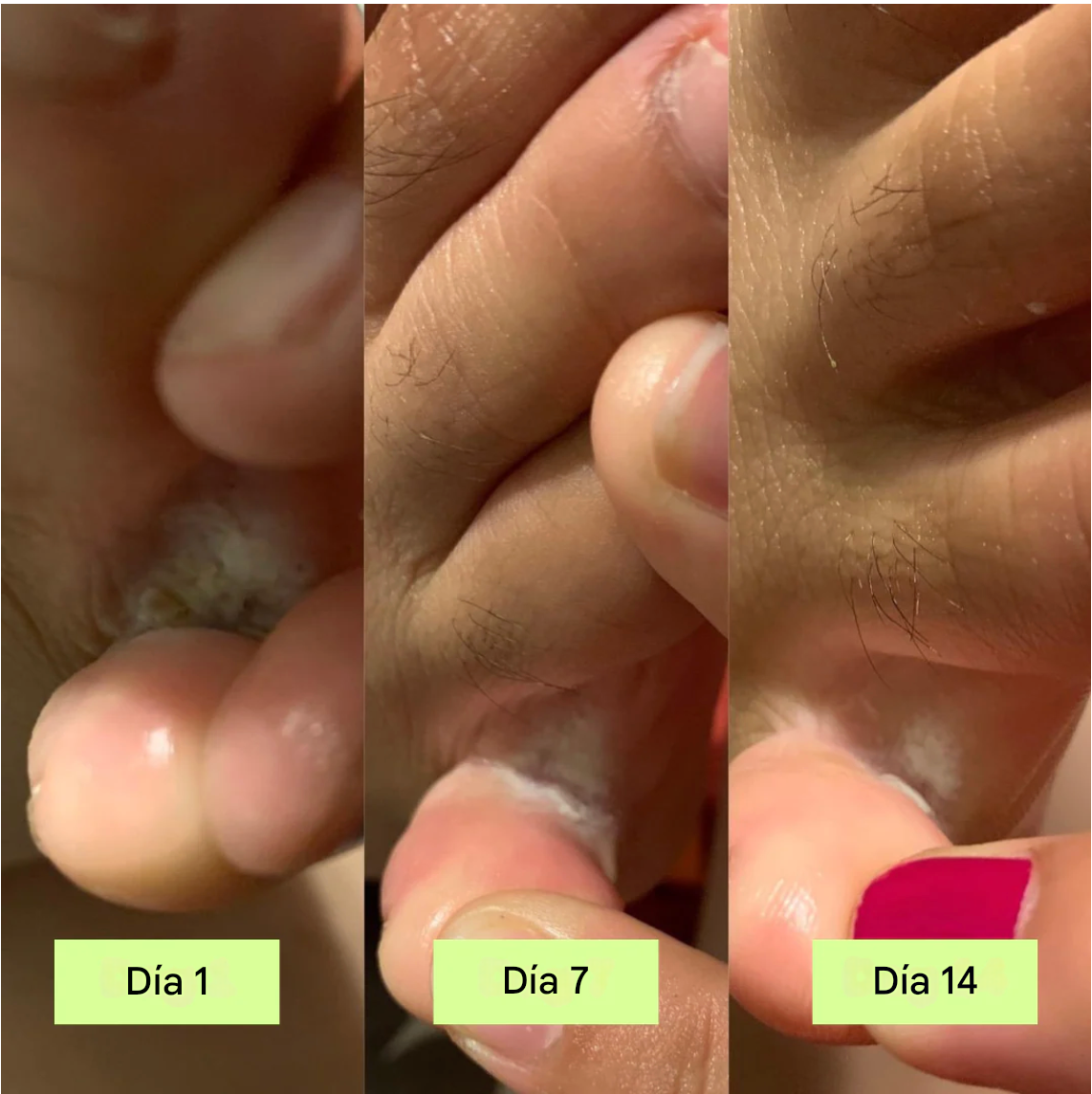 Sabonete Antifúngico Alívio Intenso